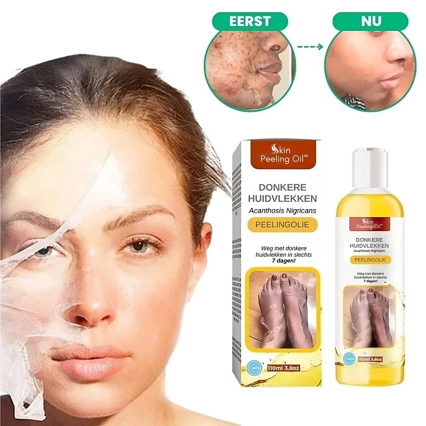Skin Peeling Oil
